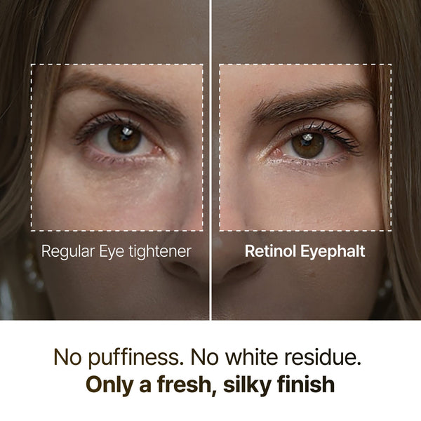 Retinol Eyebag Cream