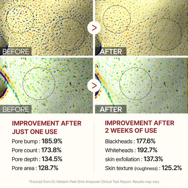 Peel Shot Glow Rice Line